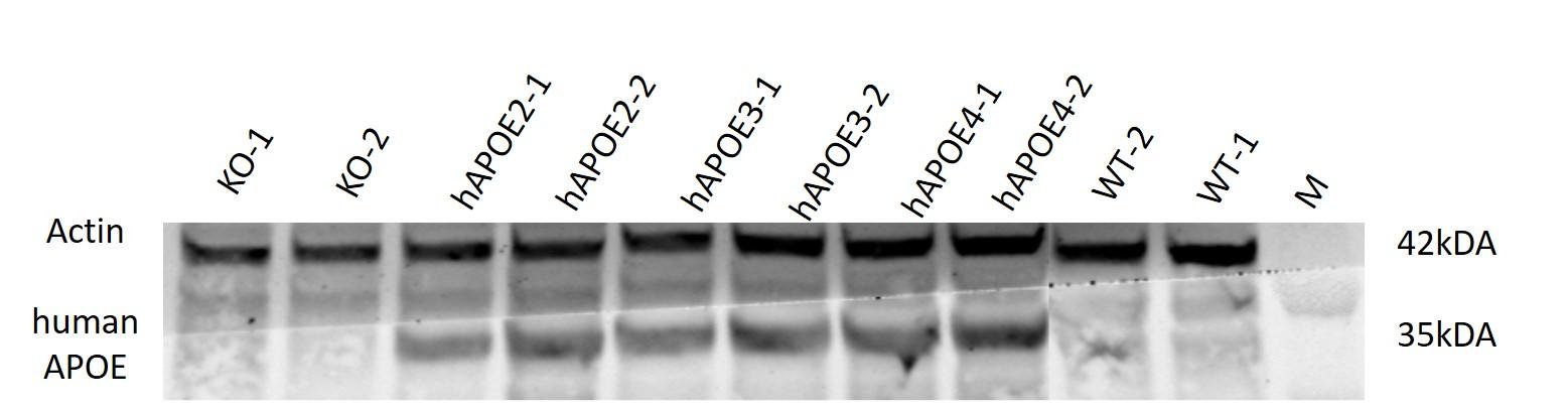 APOE2 Humanized Immune Checkpoint Mouse Model